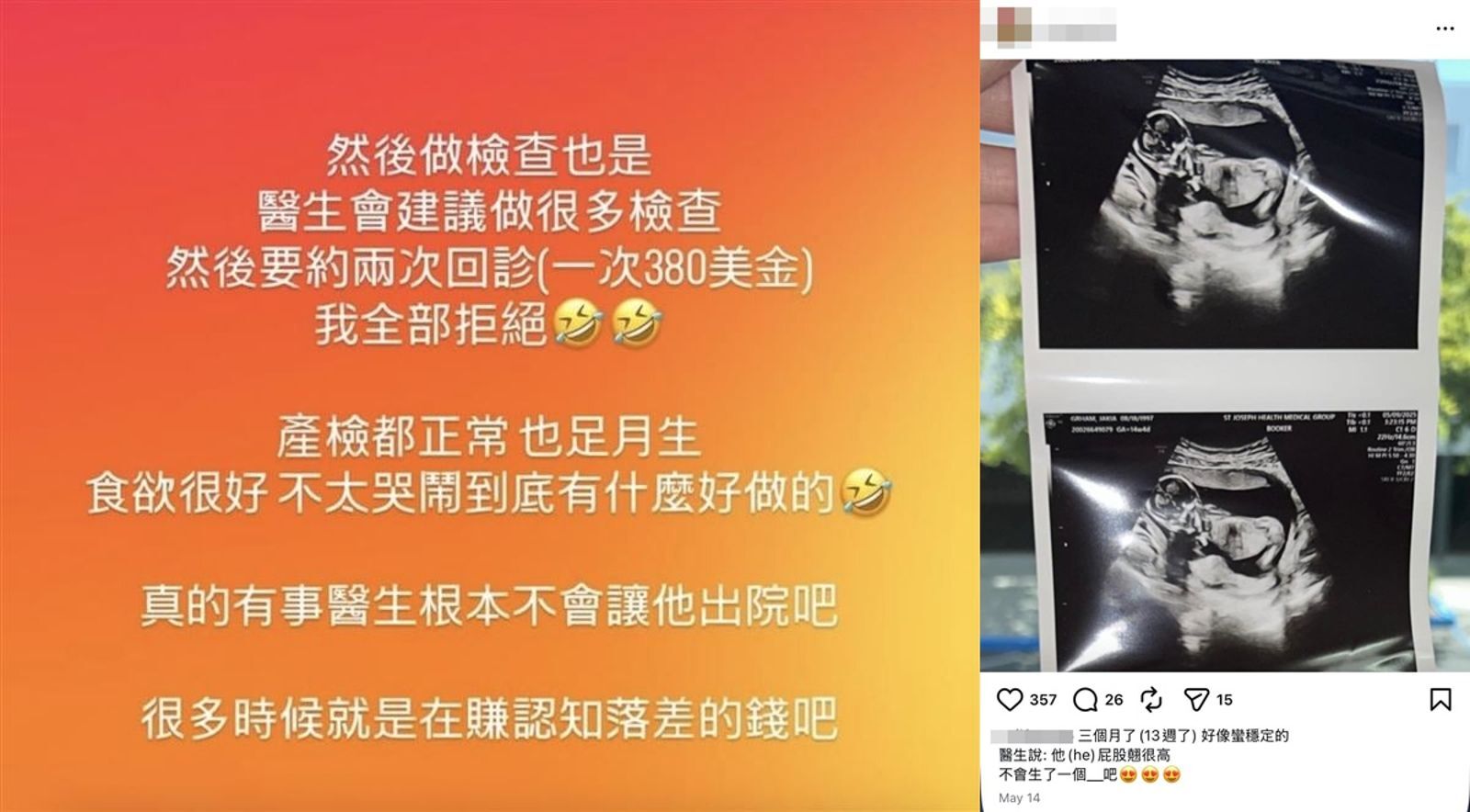 男同代孕再惹議！無碼PO孕母私處「疑慈濟醫師身分曝光」　嗆不需產檢！網轟：單位快徹查