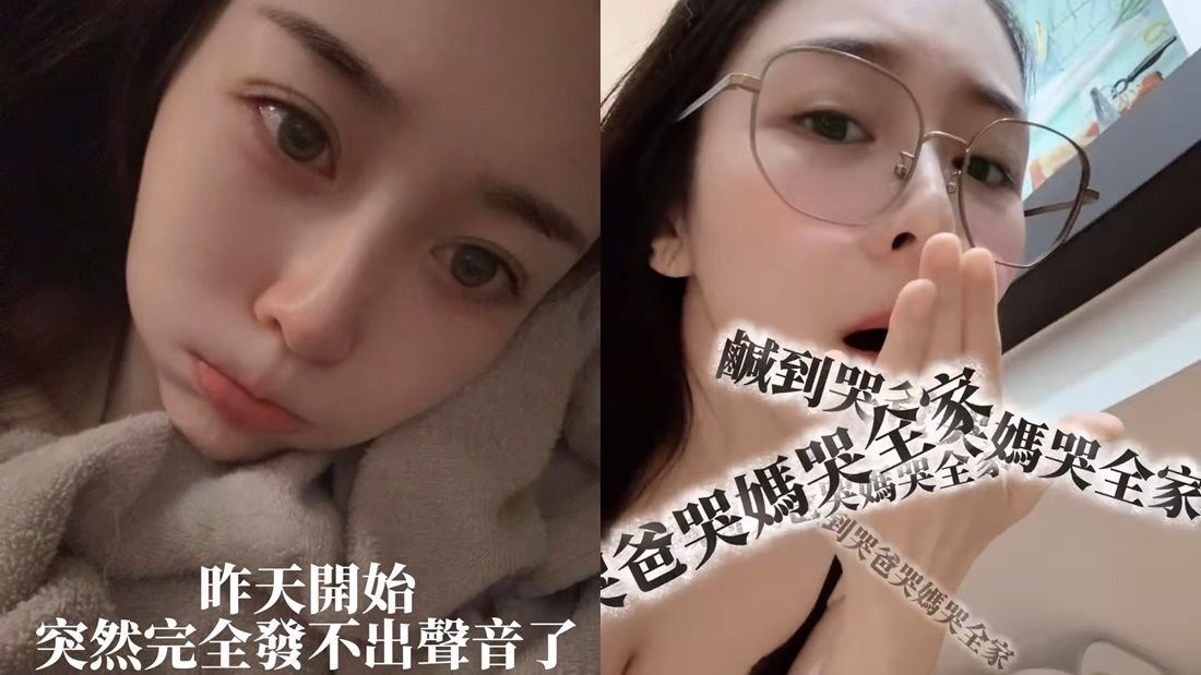 ▲Albee失聲。（圖／翻攝自Instagram／albeefin）