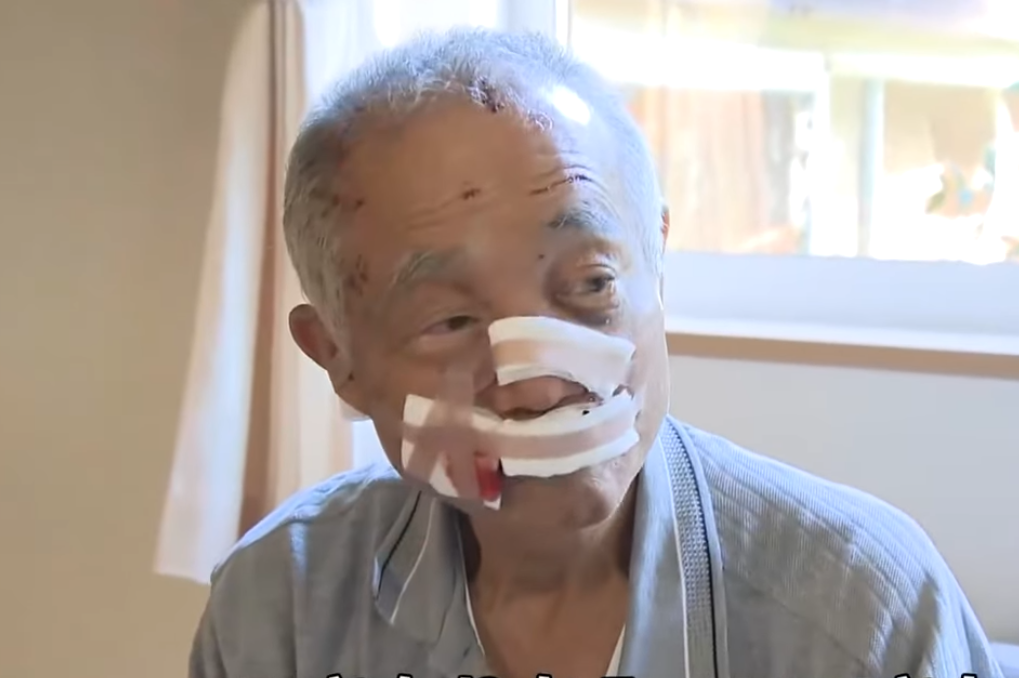 臉被抓爛！日80歲獵人遭熊撲咬斷鼻骨　回憶生死瞬間：沒時間害怕