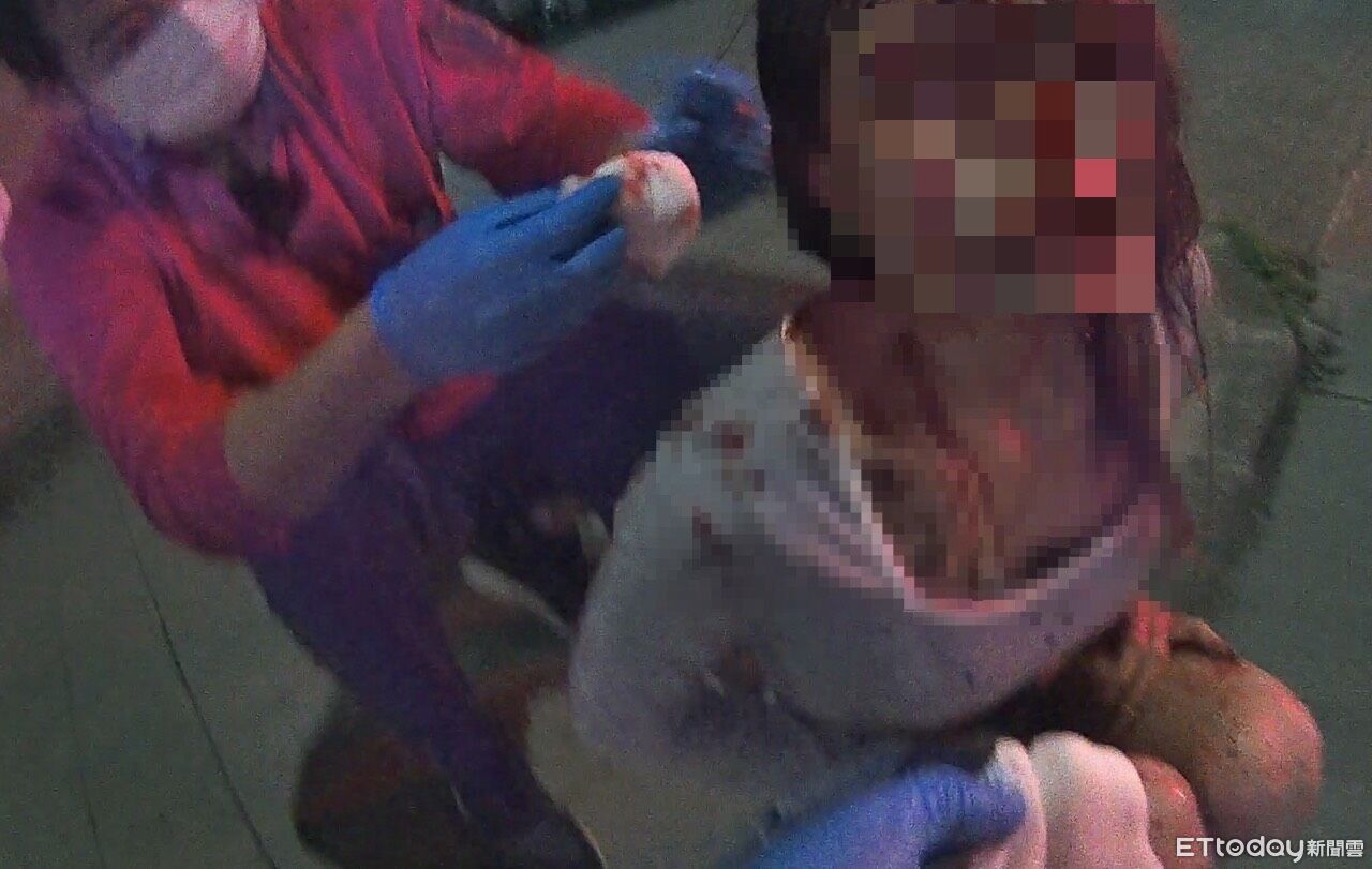 快訊/嘉義自小客自撞「車頭爛毀」! 後座19歲女滿臉血送醫