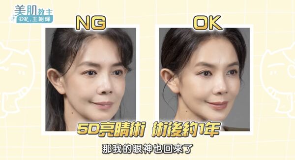 ▲▼林美貞和王朝輝醫師暢談變美心路歷程。（圖／翻攝自YouTube／美肌教主DR.王朝輝）