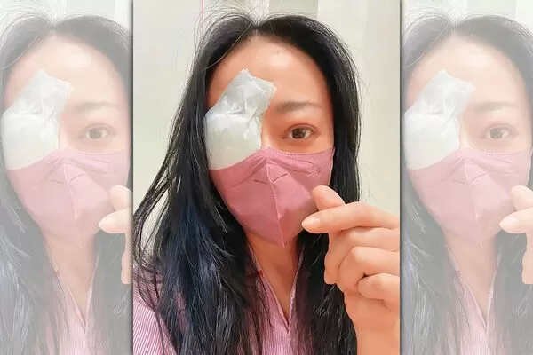 奮力抗病魔／獨家！甲狀腺引發眼疾　高慧君動3次手術恐失明