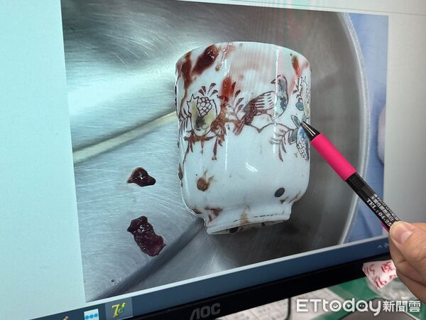 ▲▼台中男子3天無法解便，竟是肛門塞了瓷杯。（圖／李綜合醫院提供，下同）