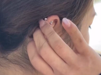 長時間配戴合金飾品發炎! 假S925飾品「致癌物超標9000倍」