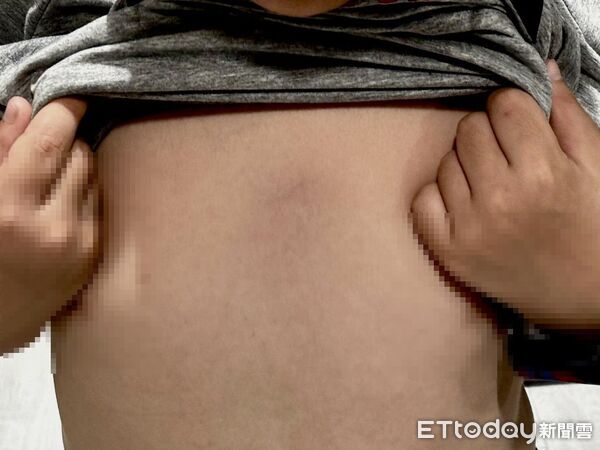 ▲台南永康區某知名連鎖安親班驚爆不當管教，家長控訴6歲兒子遭女師肘擊心窩，並驗傷報案。（圖／民眾提供，下同）