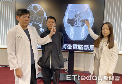 眼球卡骨頭！他車禍「臉骨全碎」剩複視後遺症　醫揭恐怖警訊