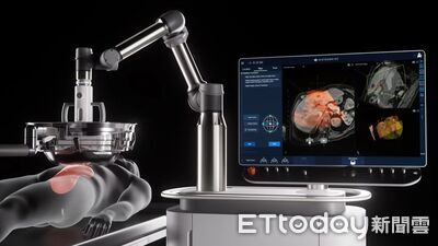 無傷口「碎化刀」治胰臟癌關注升溫　醫：超音波打不到就不能做