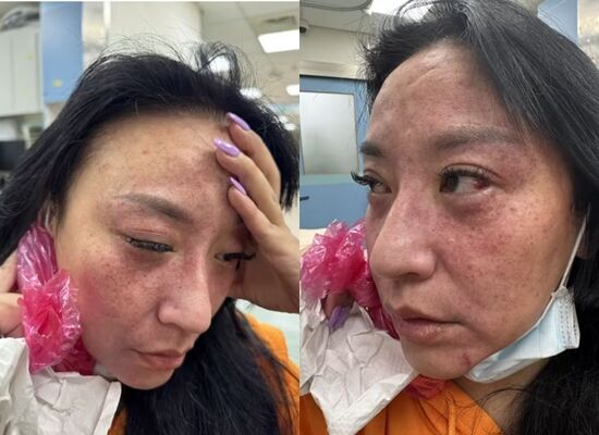 ▲安歆澐遭家暴。(圖/翻攝自YouTube/哏傳媒)