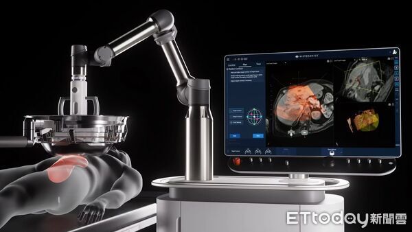 ▲▼       碎化刀      。（圖／黃凱文醫師提供）