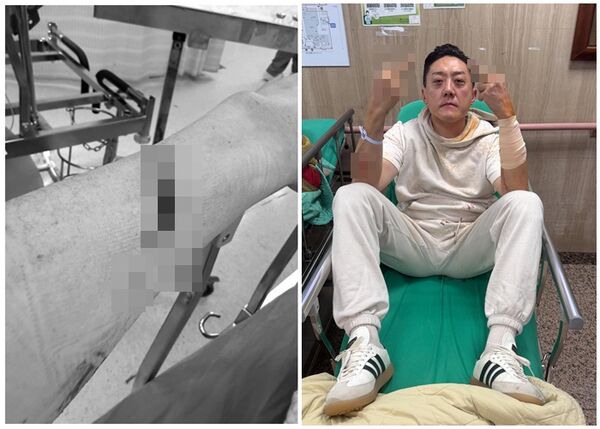 ▲▼夏天倫遭人砍傷。（圖／翻攝自Threads／Alan Hsia）