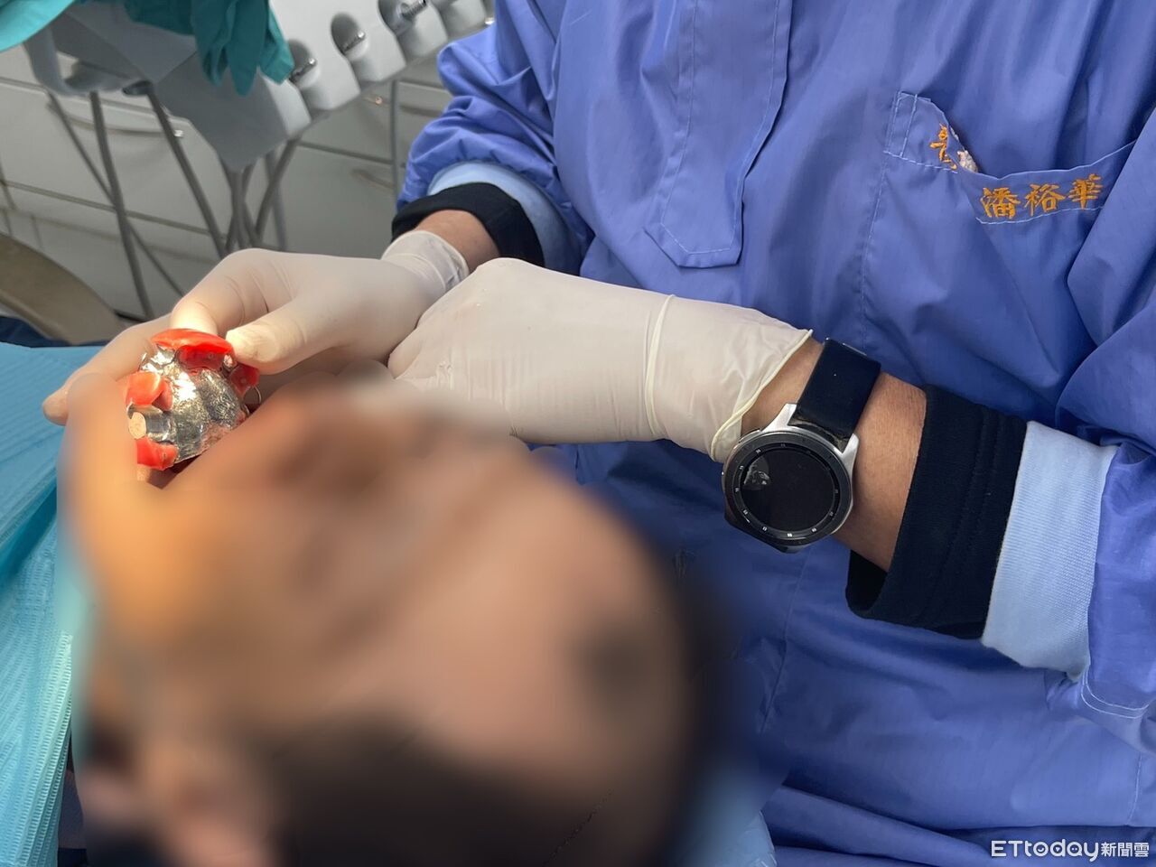 只能張口2公分!口腔癌患盼能吃飯、微笑 醫1技術神救援