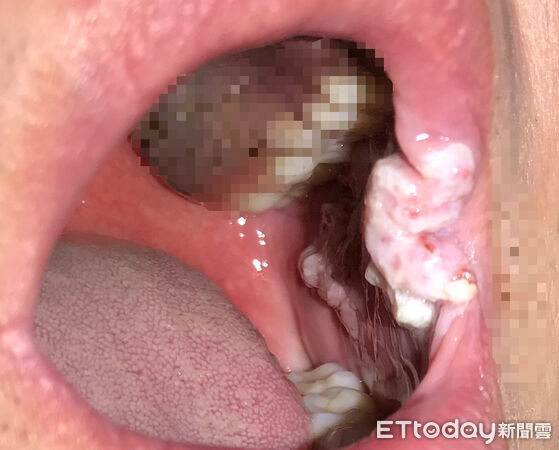 ▲▼吹口琴染菜花。（圖／吳昭寬醫師授權提供）