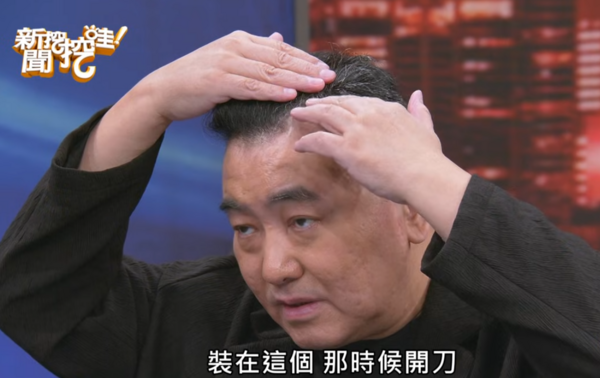 ▲徐亨長腦瘤。（圖／翻攝自YouTube／新聞挖挖哇）