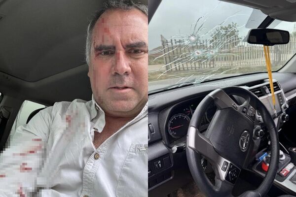 秘魯總統參選人「開車遇暗殺」滿臉血！　擋風玻璃3彈孔照片曝