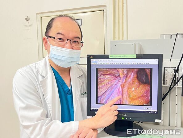 ▲腹腔鏡微創手術成復發型疝氣新解方。（圖／竹山秀傳醫院提供，下同）