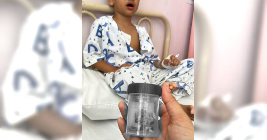 一次拔掉12顆！　男童「1壞習慣」害嚴重蛀牙、頭痛