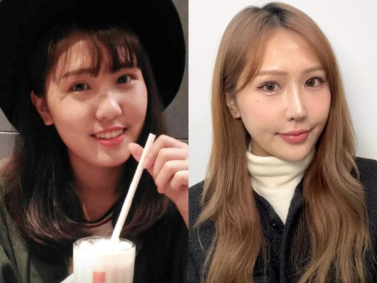 Joeman新女友「醫美前」舊照流出 　和現在判若兩人