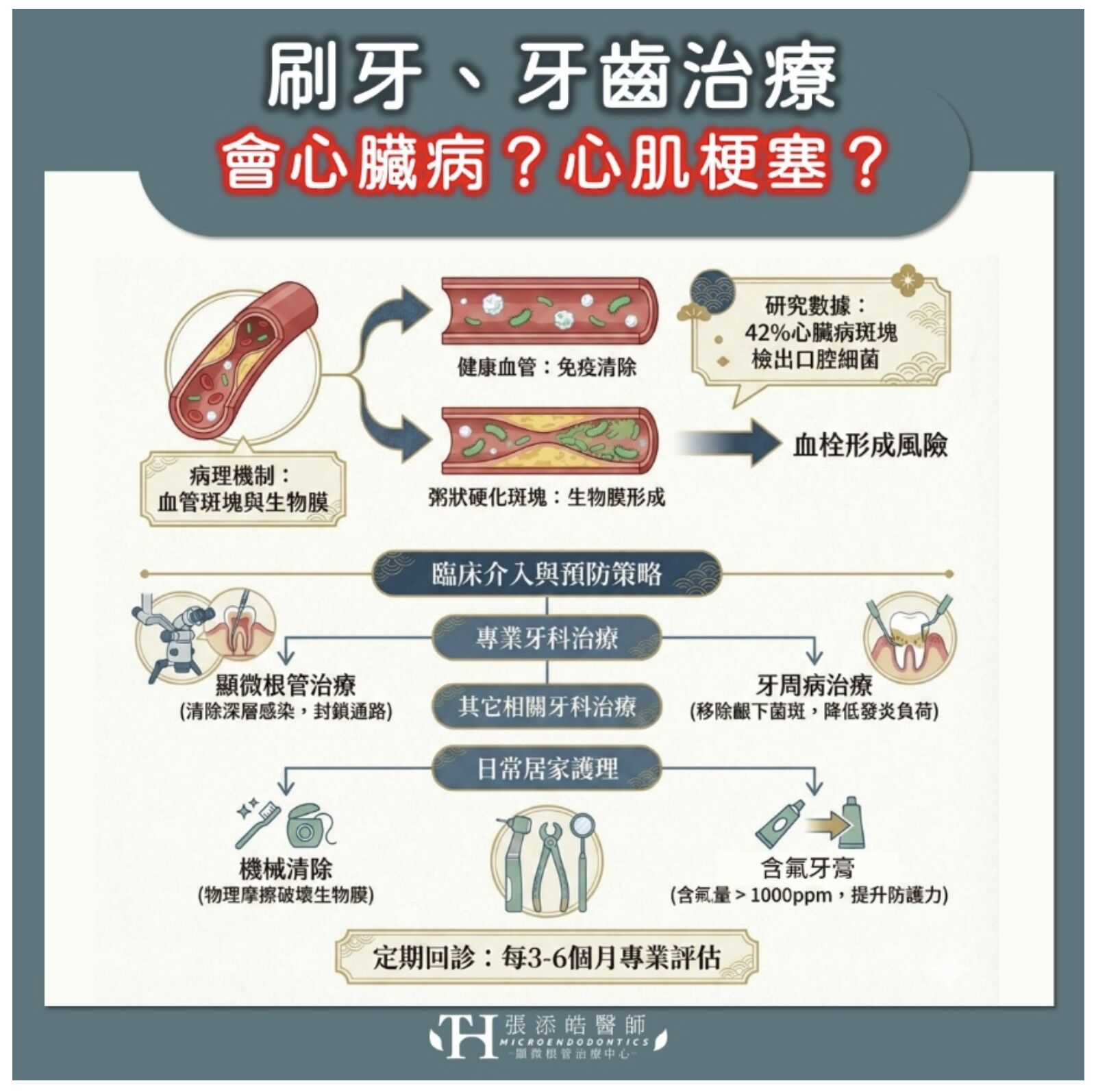 醫師破除牙齒治療會心臟病的迷思。（圖／張添皓醫師提供）