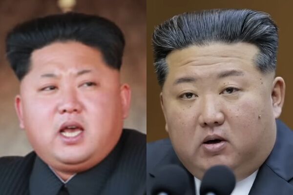 金正恩臉上長滿「詭異肉芽」！10年前對比照曝　再爆健康疑雲