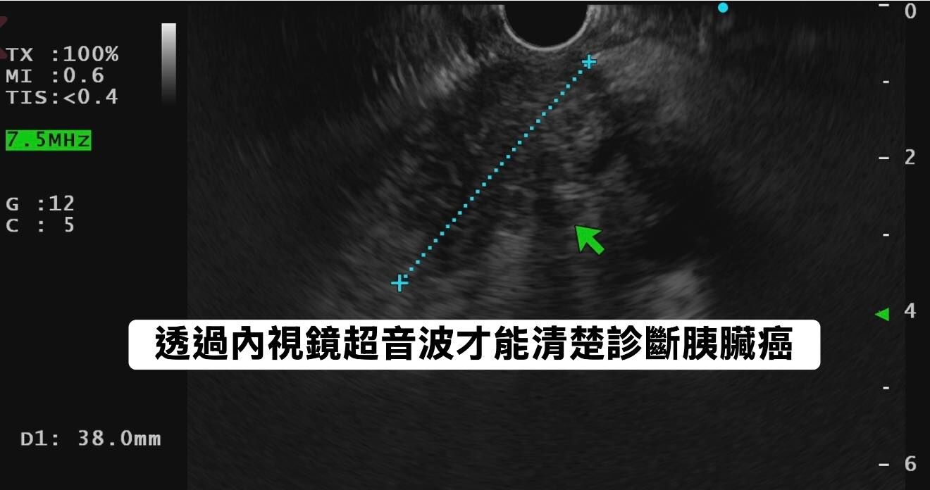 （圖／翻攝林相宏臉書）