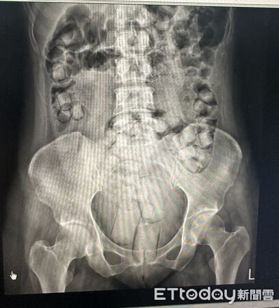 ▲▼2名泰籍女子貪圖免費遊台，口吞塞肛664公克海洛英。（圖／海巡署提供，下同）