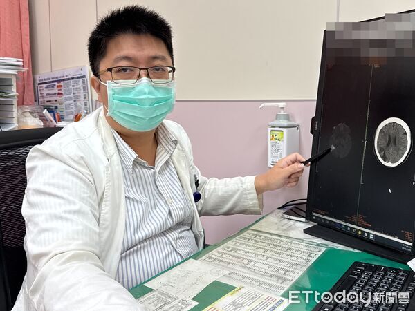 ▲沒有臉歪嘴斜！台中女視力模糊竟是中風　醫警告：再晚就半癱。（圖／李綜合醫院提供）