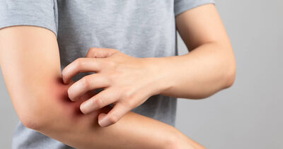 皮膚癢以為是濕疹！一檢查竟罹「淋巴癌」　醫示警6症狀：快就醫