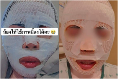 怕老婆外遇！　韓男趁泰籍妻睡著「煮沸熱水潑臉」害毀容