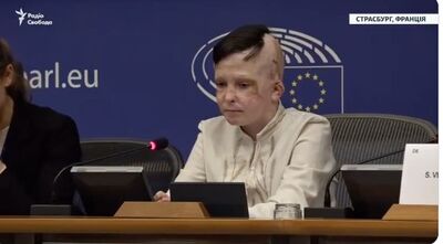 11歲「烏克蘭男孩」親述被俄軍轟炸：與母永別　口譯員當場落淚