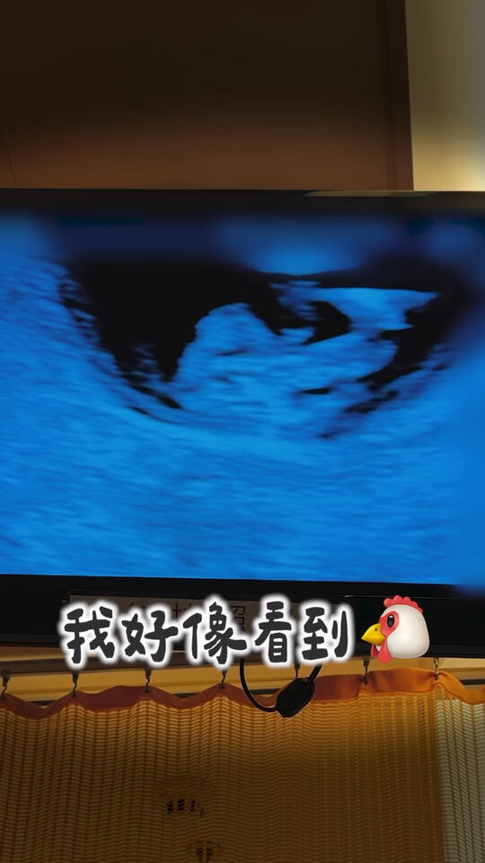 ▲▼瑀熙。（圖／翻攝自Instagram／uccu0323）