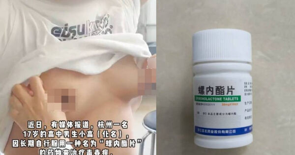 大陸浙江杭州有一名17歲男高中生自行服藥，導致乳房異常隆起。（圖／翻攝自微博／南方都市報）
