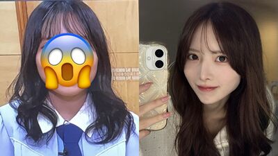 日女團前成員公開整形前長相　「砸百萬進廠維修」對比照超驚人