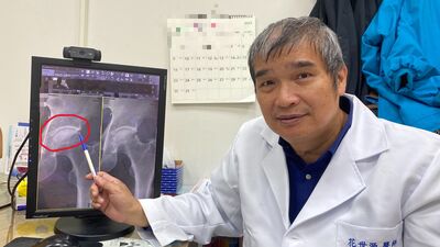 他走路沒事「一蹲下就劇痛」　長期深蹲導致「髖關節夾擊症候群」