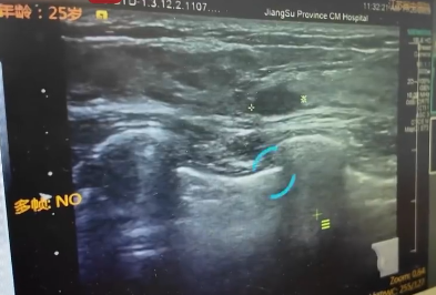 ▲女子患上「乳腺癌」。（圖／翻攝自微博）