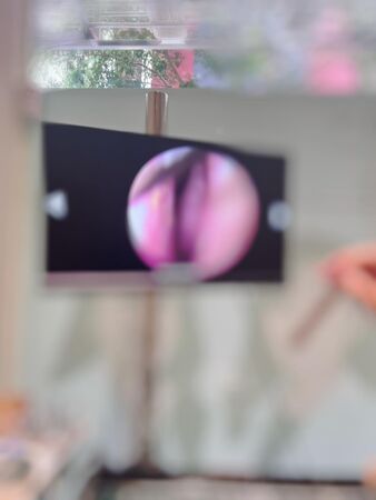 ▲▼米可白準備「一次3手術」解舊疾　看到金額猶豫。（圖／翻攝自Facebook／米可白）