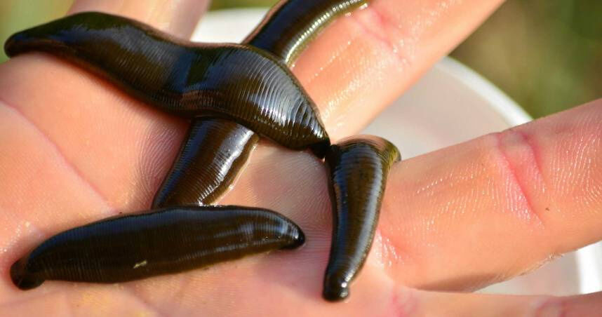 7歲女童沒穿內褲田裡玩耍　疑遭水蛭鑽入體內！私處狂流血