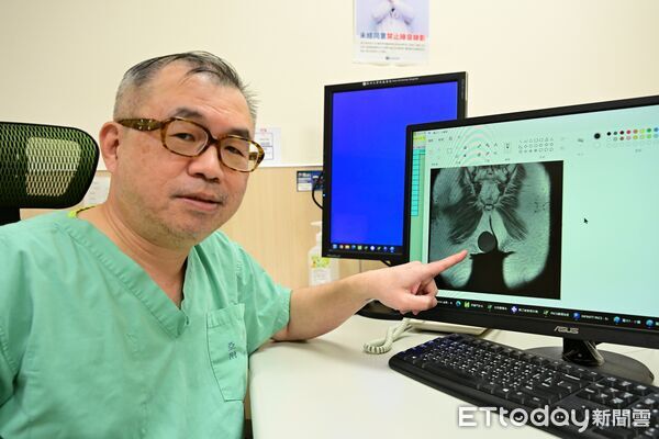 ▲瘦子也會長！她手臂冒「壯觀二頭肌」竟是巨型脂肪瘤 。（圖／亞大附醫提供）