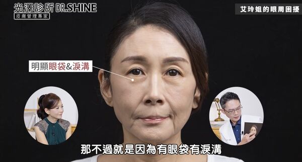 ▲▼曲艾玲。（圖／翻攝自YouTube／DR.SHINE光澤美學院）