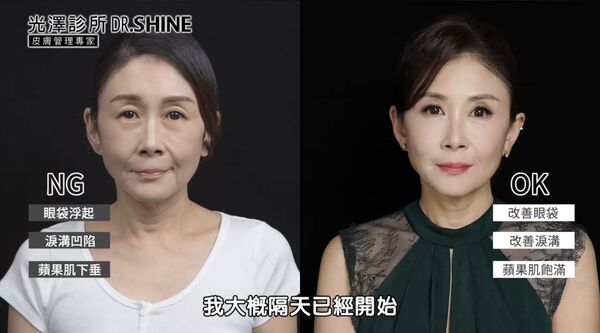 ▲▼曲艾玲。（圖／翻攝自YouTube／DR.SHINE光澤美學院）