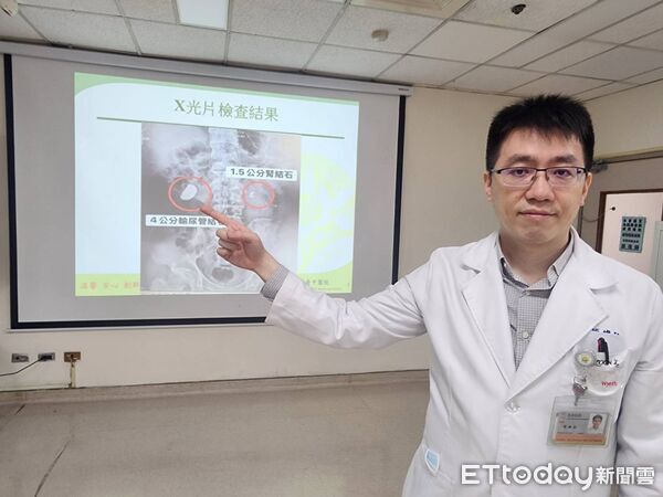 ▲台中醫院,泌尿科,結石,簡維弘。（圖／記者游瓊華攝）