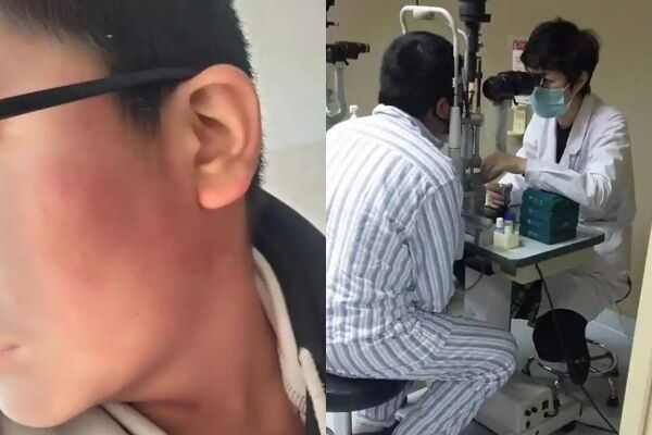 ▲▼13歲陸生遭班導掌摑致「眼睛九級傷殘」。（圖／翻攝自微博）