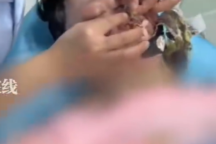 ▲▼女子遭自燃充電器火吻全身70%燒傷。（圖／翻攝自微博）