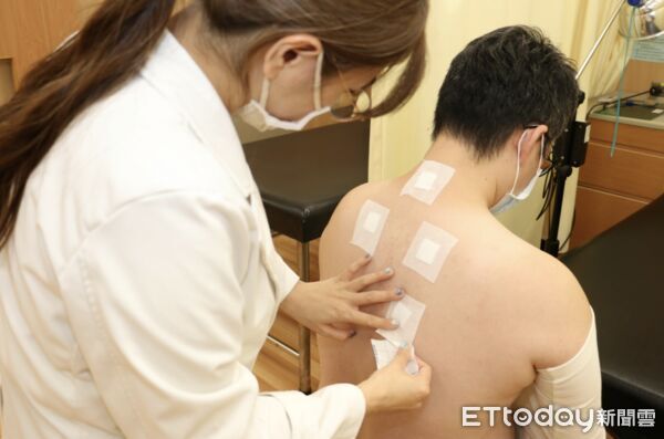 「三九貼」冬病冬治 。（圖／台中慈濟醫院提供）