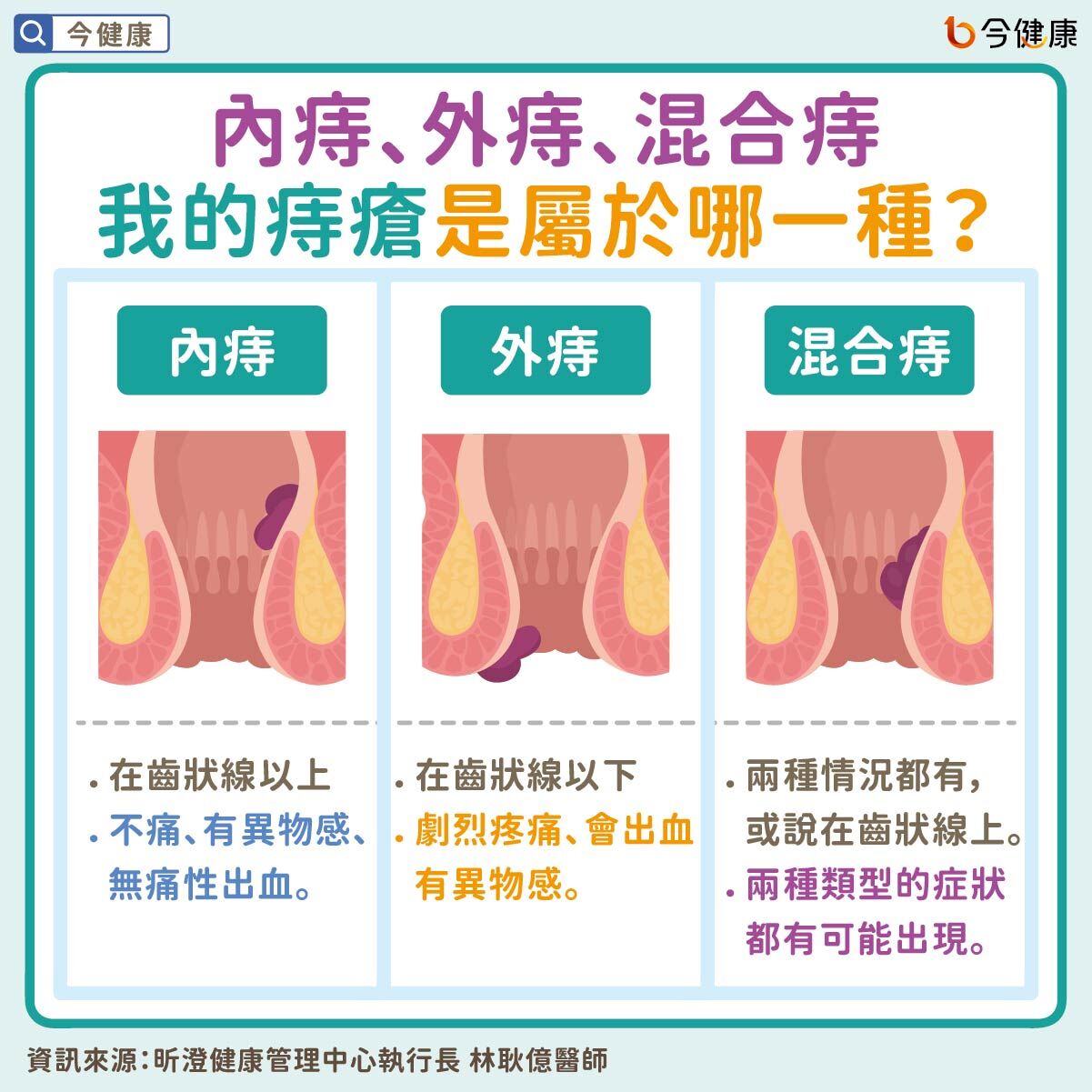 ▲一堆人有！痔瘡「1狀態」醫警告別拖了：再晚恐血栓。(圖/今健康授權提供)