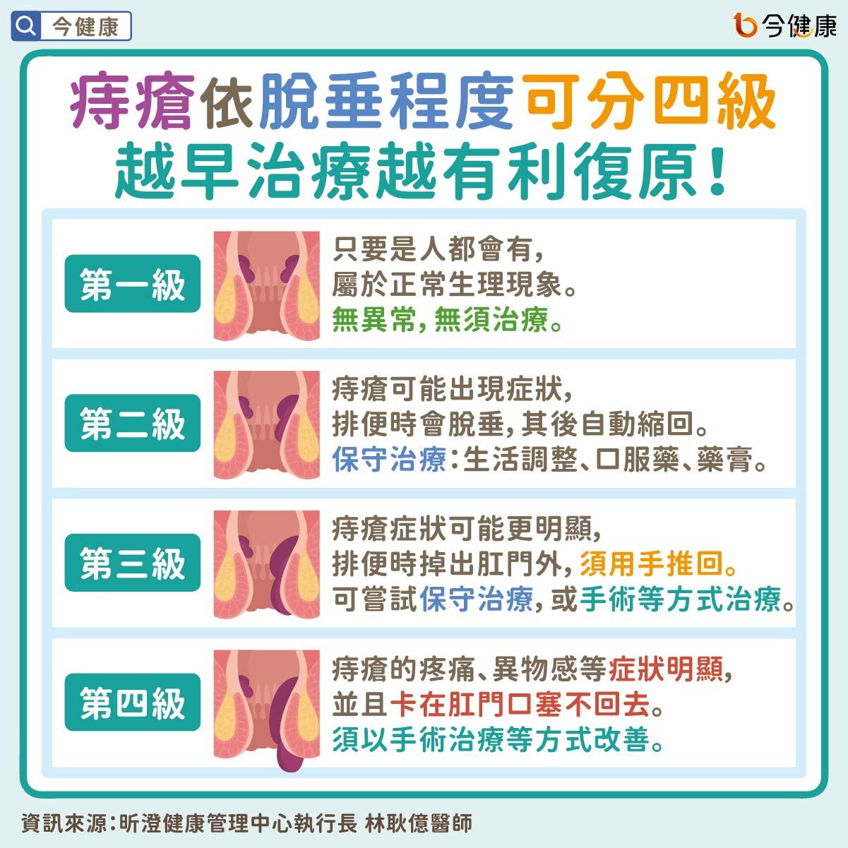 ▲一堆人有！痔瘡「1狀態」醫警告別拖了：再晚恐血栓。(圖/今健康授權提供)