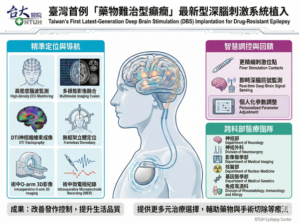 ▲▼臺灣首例「藥物難治型癲癇」最新型深腦刺激系統植入。（圖／台大醫院提供）