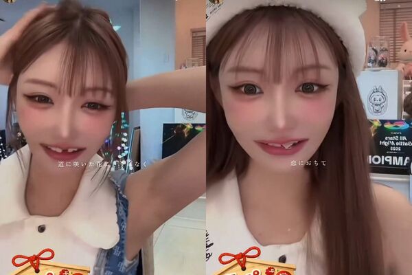 ▲▼明日花綺羅驚爆整型整到掉牙齒，網友熱議。（圖／攝自明日花キララIG、X）