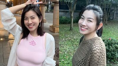 米可白自揭2月將動刀！　曬「逆齡瀏海自拍照」吐近況