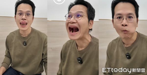 ▲打呼有救了！醫推「3個舌頭運動」防猝死：像深情的法式舌吻。(圖／陳亮宇醫師授權提供）