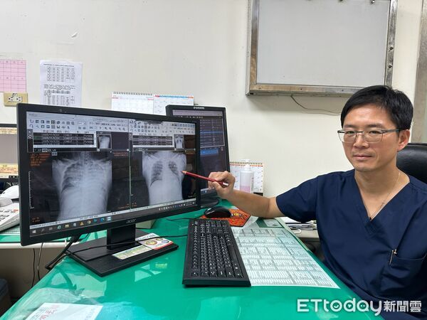 ▲豐原醫院,張正一。（圖／豐原醫院提供）